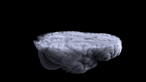 Brain