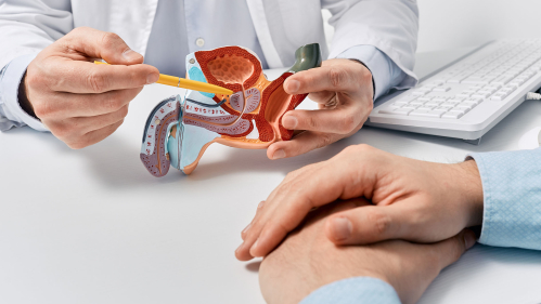 doctor shows model prostate