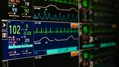 Vital signs monitor display at ICU in hospital.