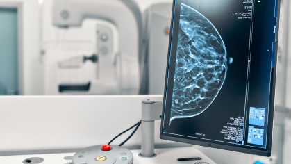 mamogram in doctors office