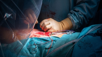 surgeon operates on chest