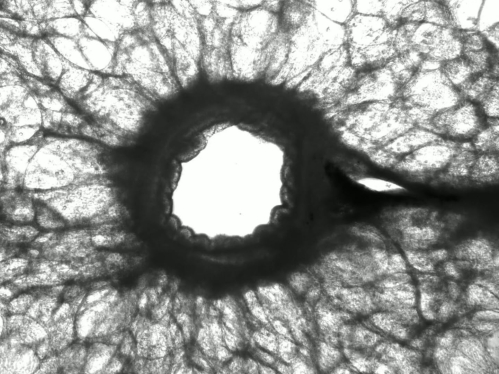 A black and white image of lung tissue 