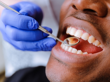 dentist examines mouth