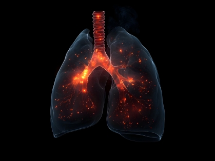 Inflammed lung illustration